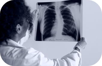 Doença Pulmonar Obstrutiva Crônica (DPOC)