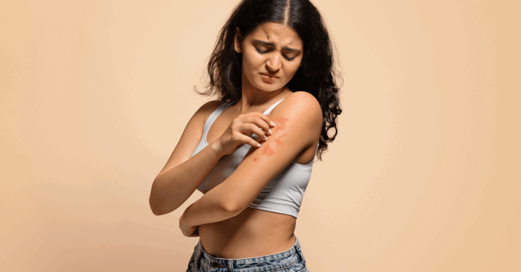 Tratamento da Psoríase em Placas: O Que Mudou em 2025?